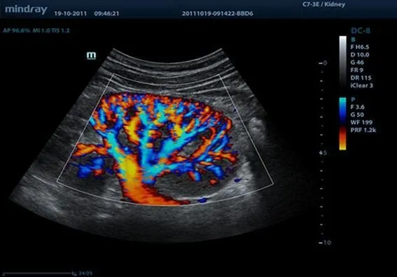 Клинические изображения УЗИ аппарат Mindray DC-8