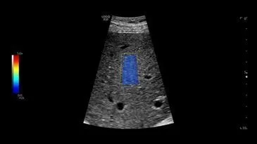 Клинические изображения GE HealthCare Logiq E10 ультразвуковая система