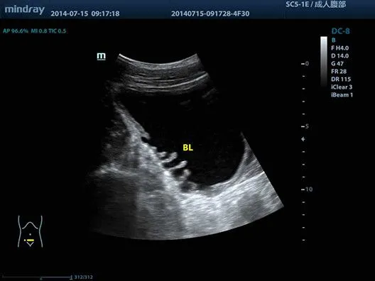 Клинические изображения УЗИ аппарат Mindray DC-8 Exp