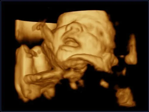 Клинические изображения УЗИ аппарат Esaote MyLab ClassC