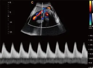 Клинические изображения УЗИ аппарат Chison SonoTouch 80 Pro портативный