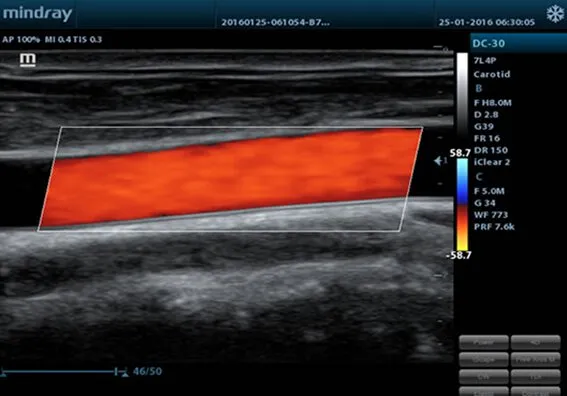 Клинические изображения Mindray M5