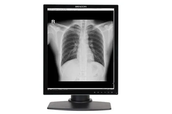 Монитор медицинский Millennium G32SP Монитор медицинский Millennium G32SP