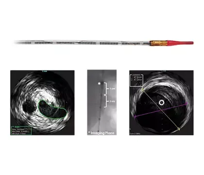 Philips Visions PV (0,035 дюйма) катетер ротационный Philips Visions PV (0,035 дюйма) катетер ротационный