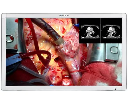 Монитор медицинский Millennium S421P Монитор медицинский Millennium S421P