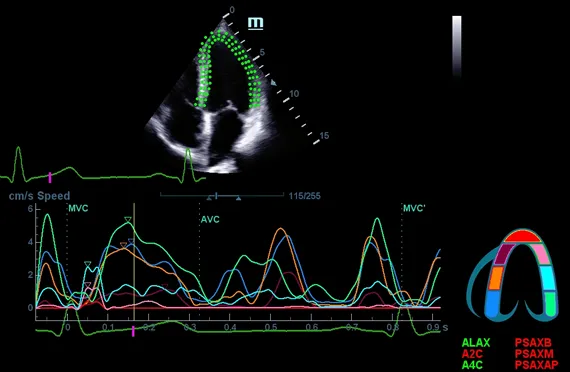 Клинические изображения УЗИ аппарат Mindray DC-45