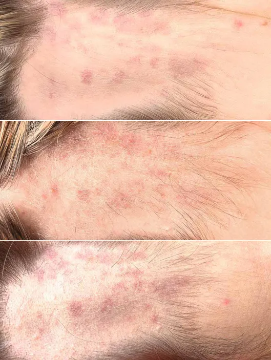 image_2025-03-17_17-40-35.png image_2025-03-17_17-40-35.png