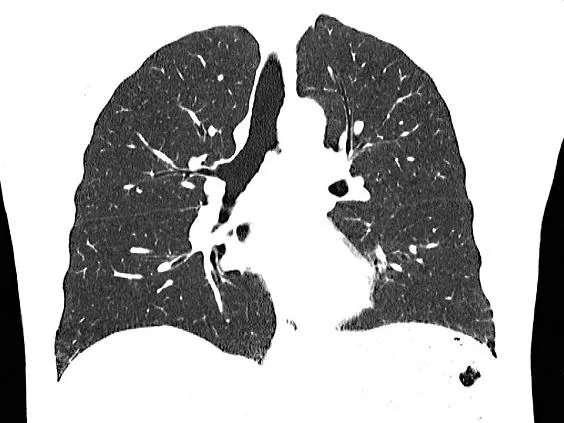 Клинические изображения Siemens SOMATOM go.Up компьютерный томограф