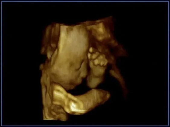 Клинические изображения УЗИ аппарат Esaote MyLab Twice