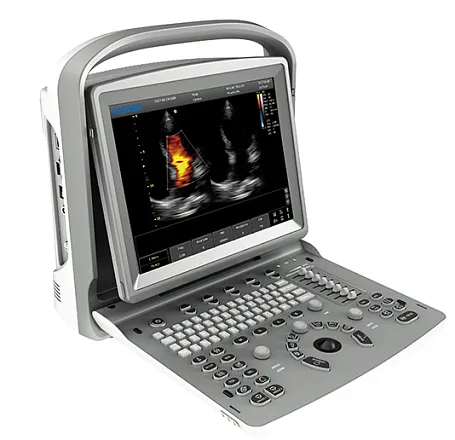 УЗИ аппарат Chison ECO 6 УЗИ аппарат Chison ECO 6
