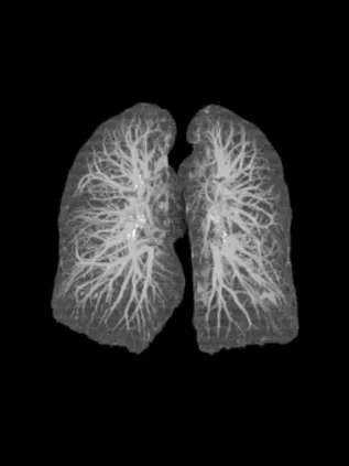 Клинические изображения Компьютерный томограф GE Optima CT540