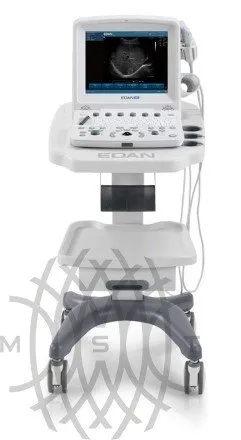 УЗИ аппарат Edan U50 Prime Edition