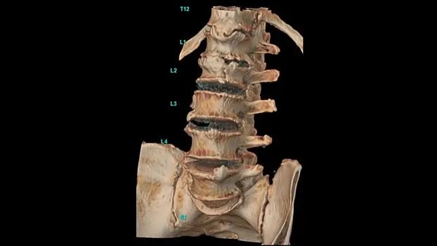 Клинические изображения Компьютерный томограф GE Revolution Ascend