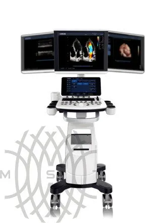 Chison Qbit 6 ультразвуковой аппарат