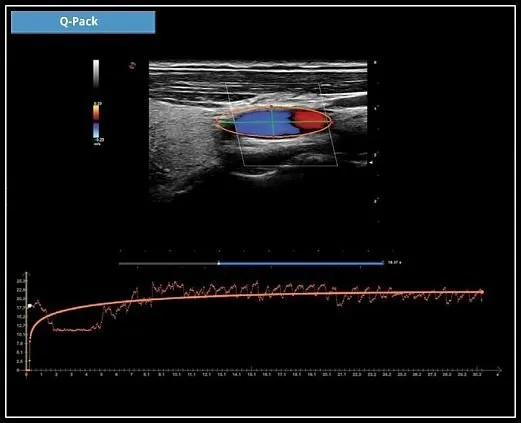 Клинические изображения УЗИ аппарат Esaote MyLab X7