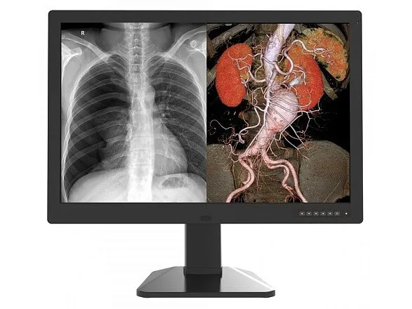 Монитор медицинский Jusha C61 Монитор медицинский Jusha C61