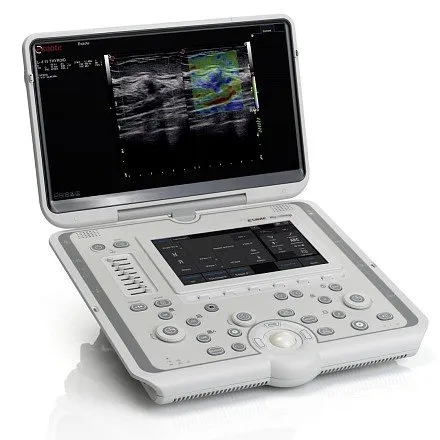 УЗИ аппарат Esaote MyLab Omega УЗИ аппарат Esaote MyLab Omega