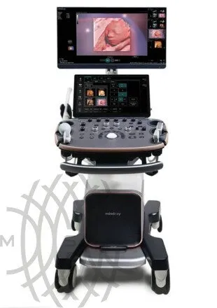 УЗИ аппарат Mindray Imagyn I9
