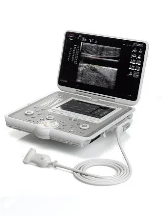 УЗИ аппарат Esaote MyLab Sigma УЗИ аппарат Esaote MyLab Sigma