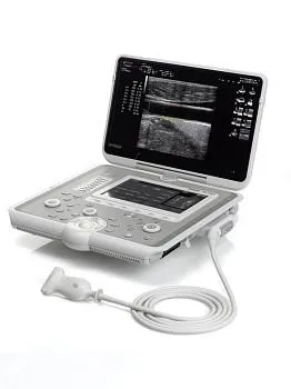 УЗИ аппарат Esaote MyLab Sigma