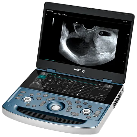 Портативный УЗИ аппарат Mindray MX8 Exp Портативный УЗИ аппарат Mindray MX8 Exp