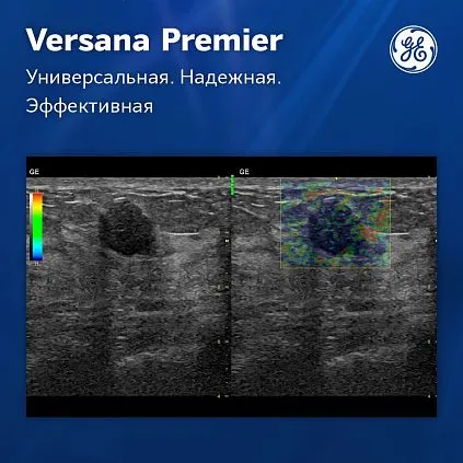 Клинические изображения Versana Premier Black GE Healthcare