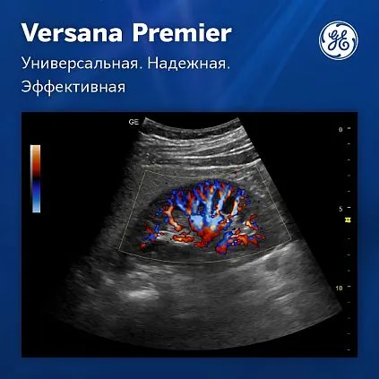 Клинические изображения Versana Premier Black GE Healthcare