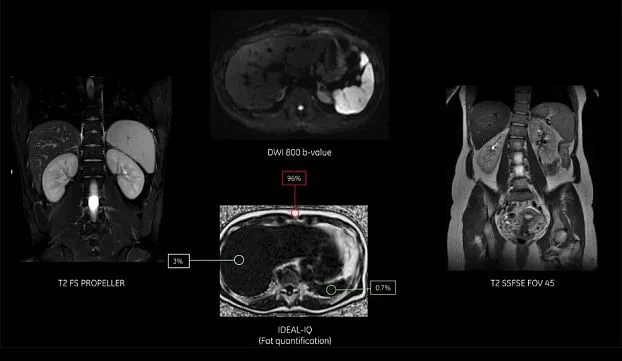 Клинические изображения Mindray M5