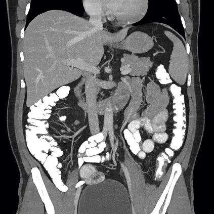 Клинические изображения Siemens SOMATOM go.Top компьютерный томограф