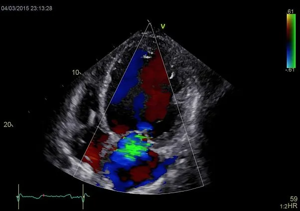 Клинические изображения УЗИ аппарат GE HealthCareVivid E90