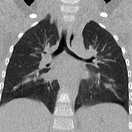 Клинические изображения Siemens SOMATOM go.Top компьютерный томограф