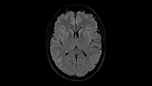 Клинические изображения Магнитно-резонансный томограф Siemens MAGNETOM Free.Max