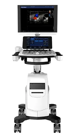 Chison Qbit 6 ультразвуковой аппарат Chison Qbit 6 ультразвуковой аппарат