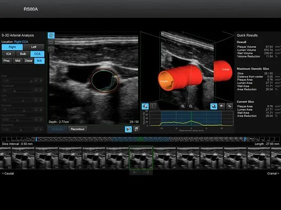 Клинические изображения Samsung Medison RS80A УЗИ аппарат