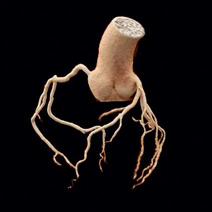 Клинические изображения Siemens SOMATOM go.All компьютерный томограф