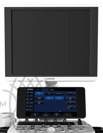 Chison Qbit 6 ультразвуковой аппарат