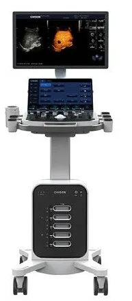 Chison i9 ультразвуковой аппарат Chison i9 ультразвуковой аппарат