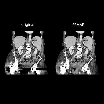 Клинические изображения Компьютерный томограф Canon Aquilion Prime SP
