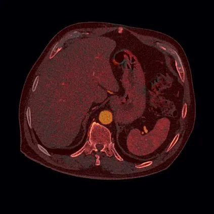Клинические изображения Siemens SOMATOM go.Top компьютерный томограф