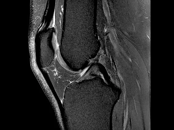 Клинические изображения Магнитно-резонансный томограф GE HealthCare Optima MR450w