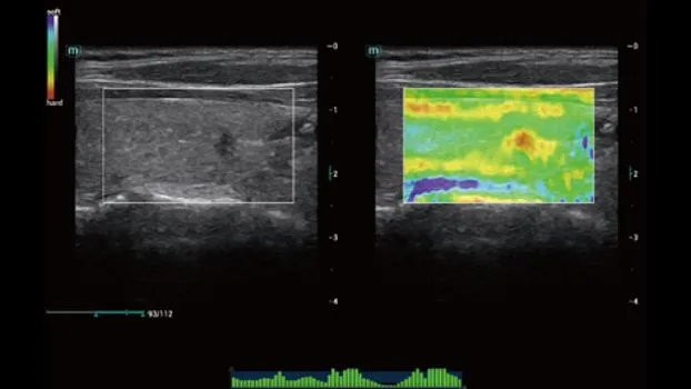 Клинические изображения УЗИ аппарат Mindray Consona N7