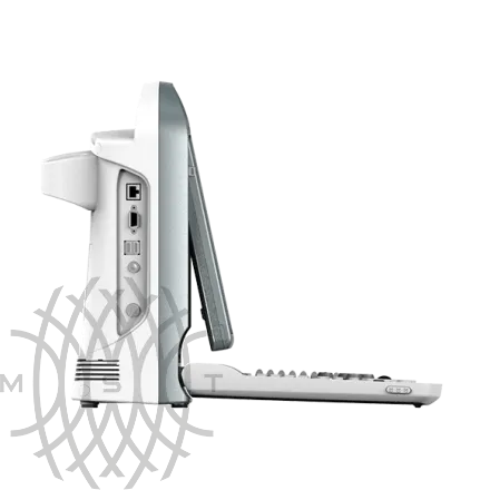 УЗИ аппарат Chison ECO 5