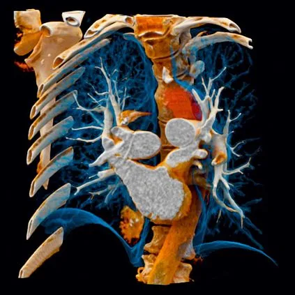 Клинические изображения Siemens SOMATOM go.Top компьютерный томограф