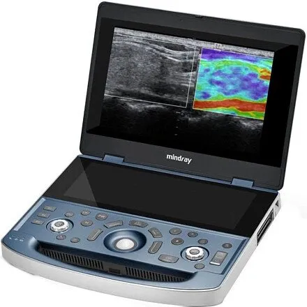 УЗИ аппарат Mindray MX7 Exp портативный УЗИ аппарат Mindray MX7 Exp портативный