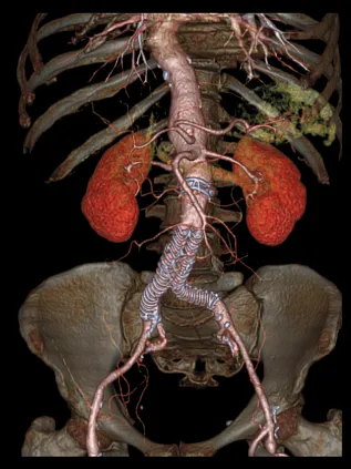 Клинические изображения Компьютерный томограф GE Optima CT540