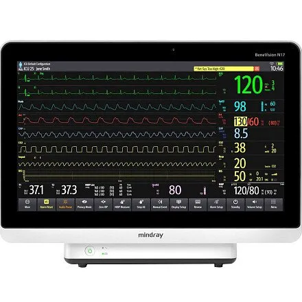Монитор пациента Mindray BeneVision N17 Монитор пациента Mindray BeneVision N17