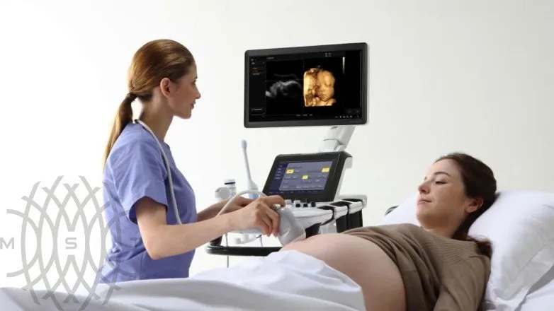 Samsung Medison UGEO H60 УЗИ аппарат