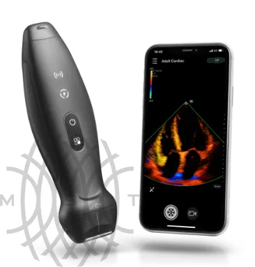 УЗИ аппарат Mindray TEAir