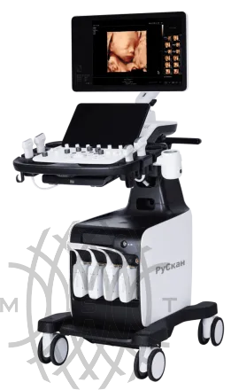 УЗИ аппарат РуСкан 80