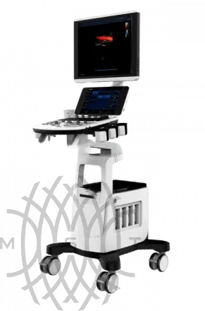 Chison Qbit 6 ультразвуковой аппарат